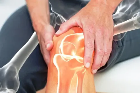 Cara Mudah Merawat Kesehatan Sendi Lutut dengan Ampuh dan Efektif