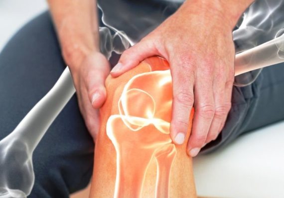 Cara Mudah Merawat Kesehatan Sendi Lutut dengan Ampuh dan Efektif