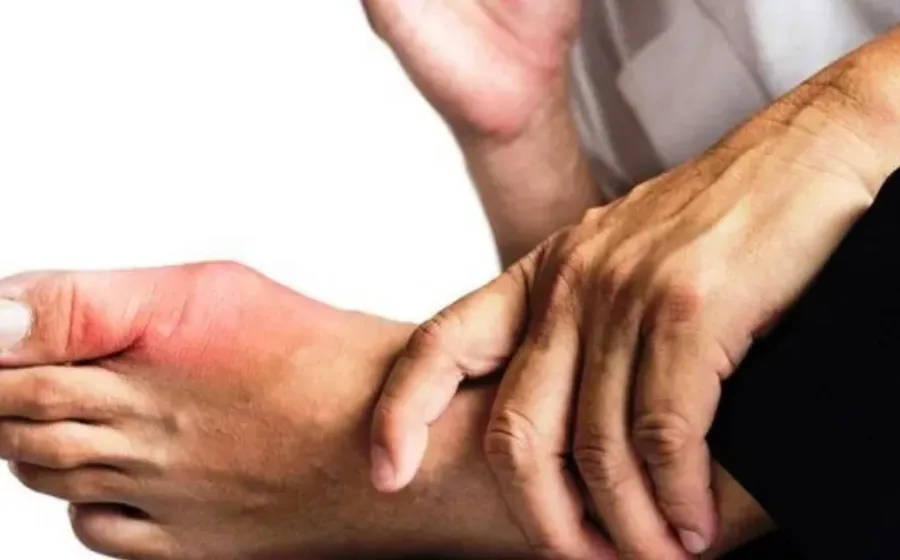 Kenali Gejala Asam Urat (Gout), Penyebab dan Faktor Risiko